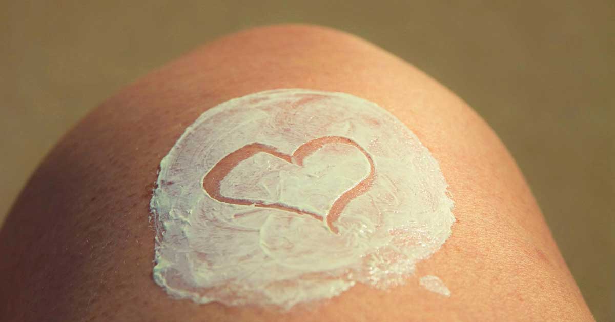  Kako izlečiti opekotine od Sunca