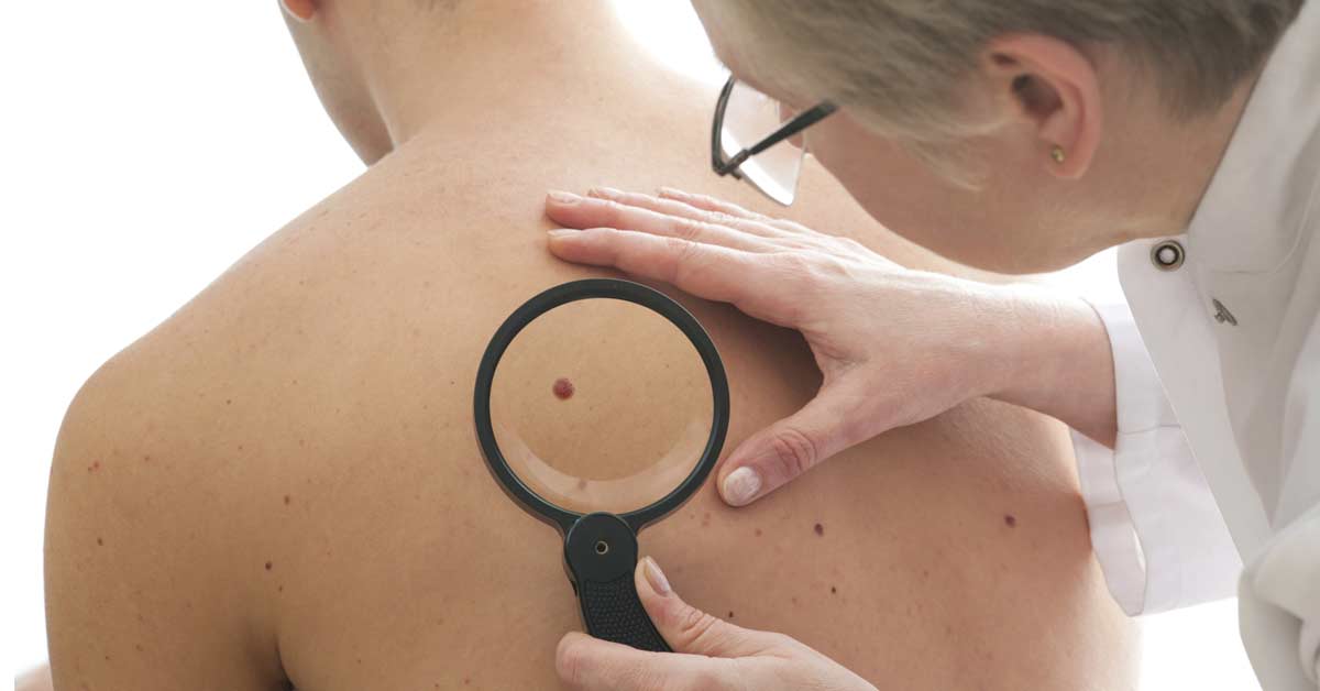  Kada treba da uklonim mladež?