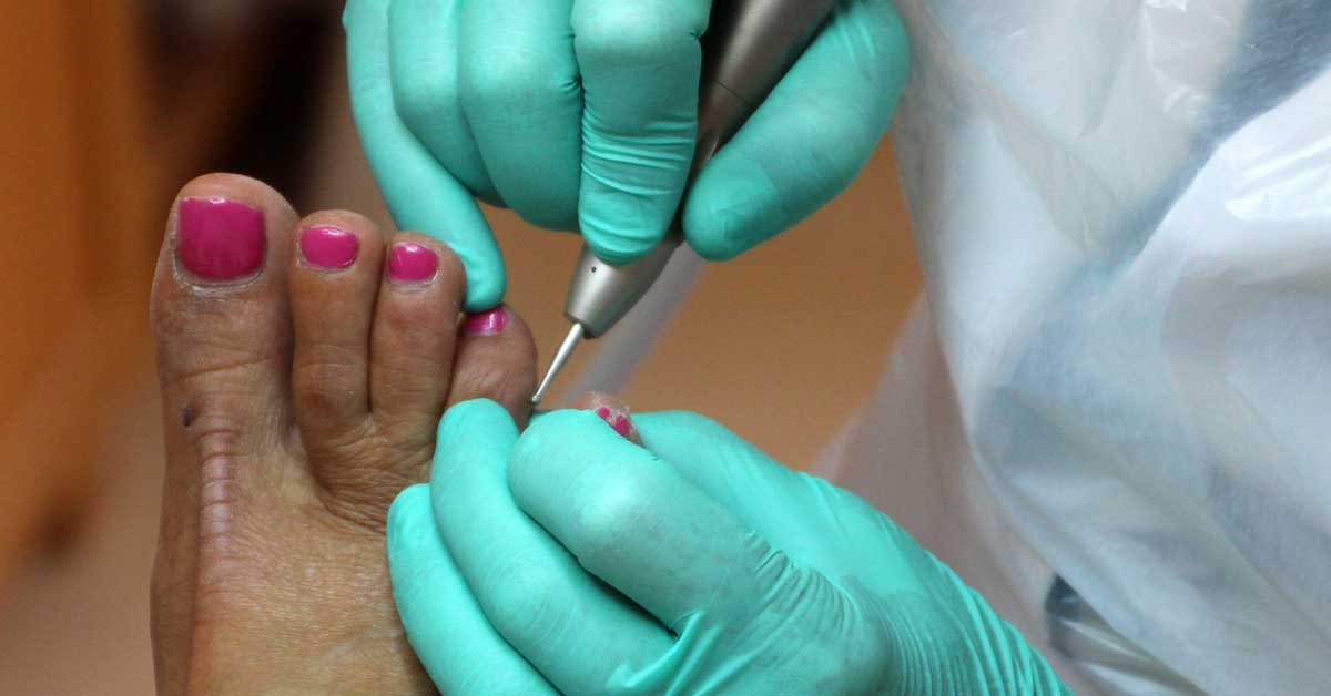  Da li je medicinski pedikir ono što vama treba