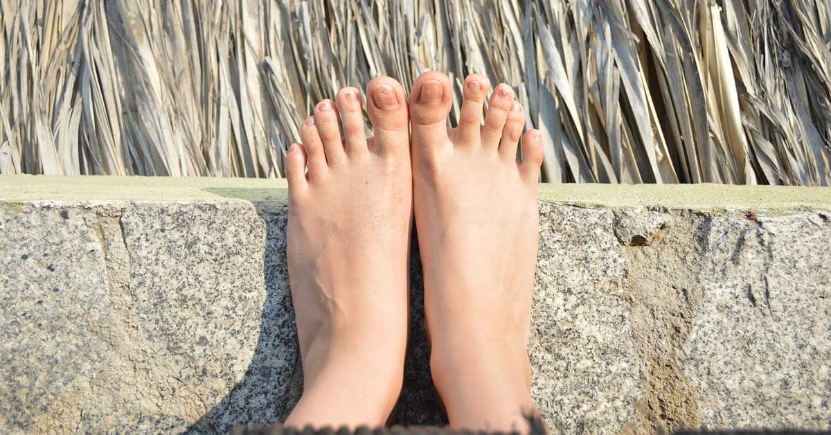  Šta vam poručuju žuti nokti na nogama?