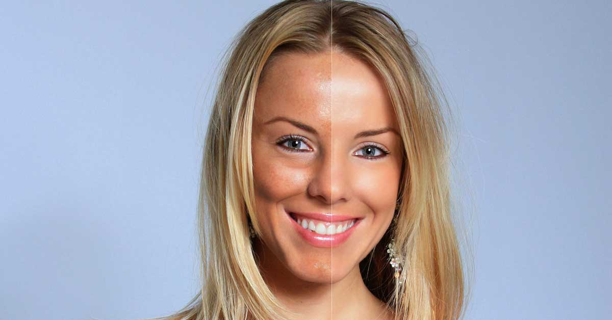  Šta je to fotostarenje kože lica i koliko je opasno?