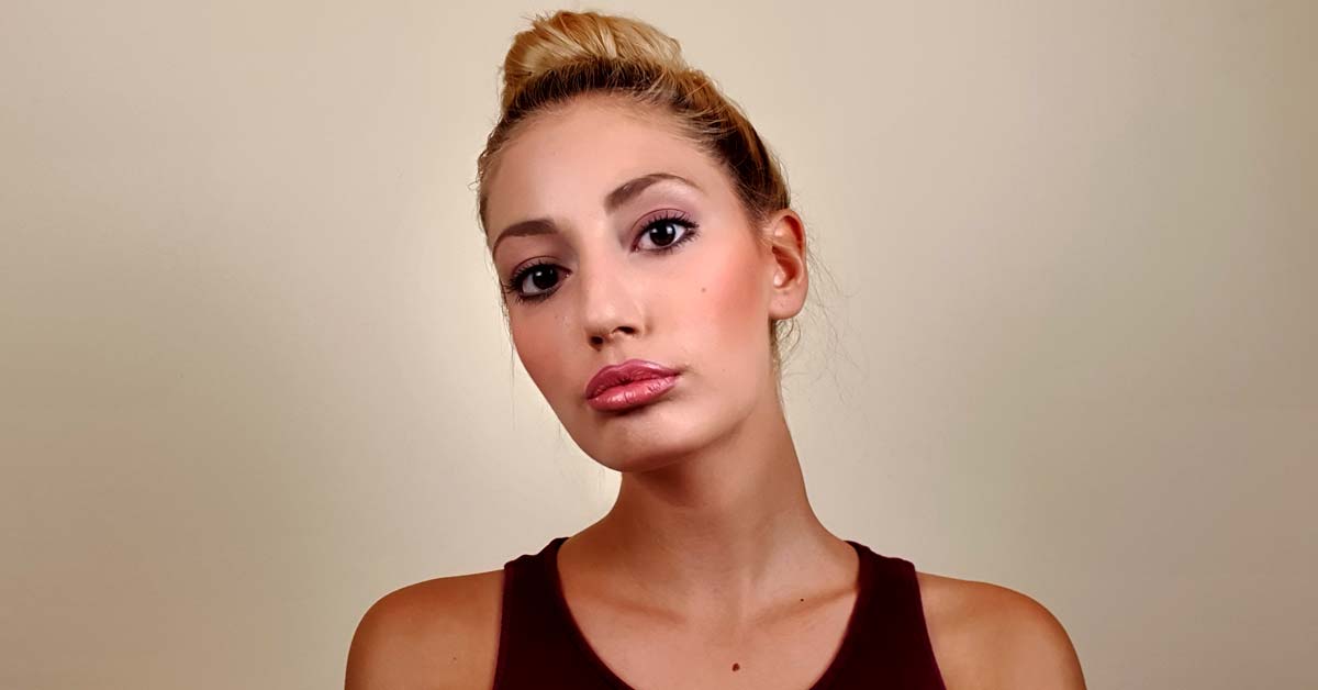  Ma kakvi fileri! Ja sam povećala usne prirodnim putem!