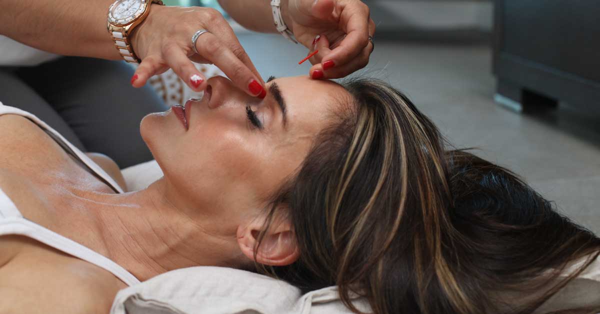  Estetska akupunktura lica kao alternativa botoksu!