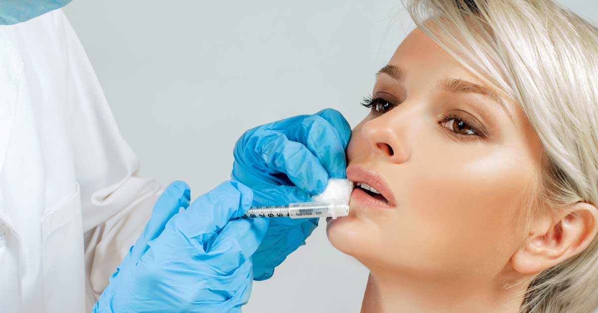  Povećanje usana biopolimerom – ima li više mana nego prednosti?