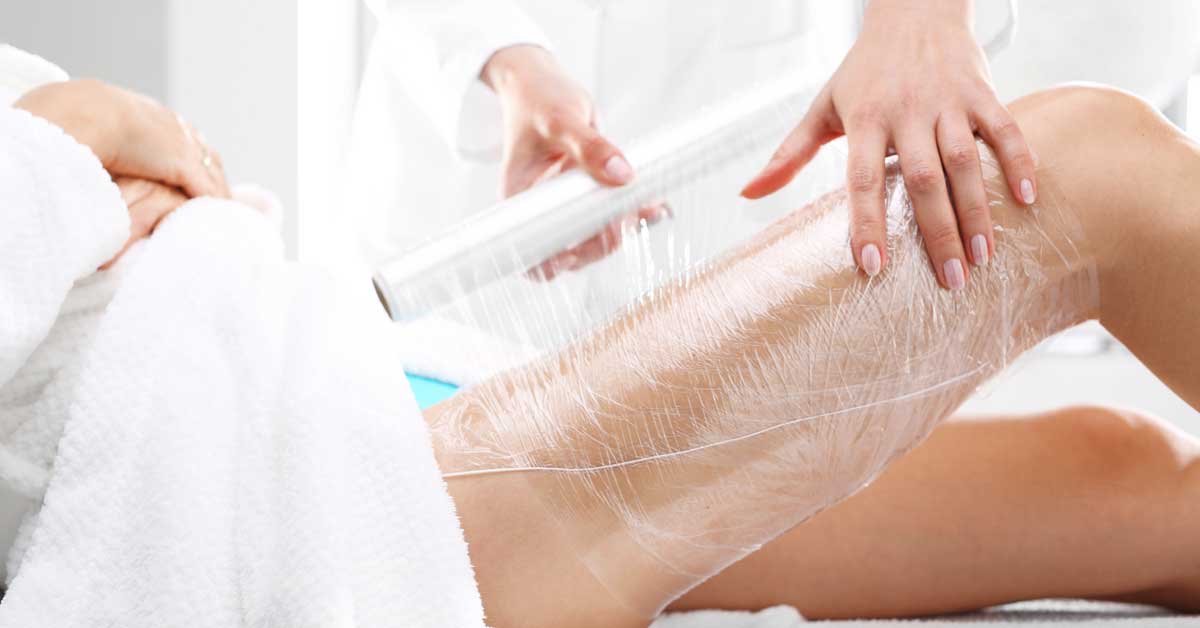  Stavite ove obloge protiv celulita i uživajte u rezultatima!