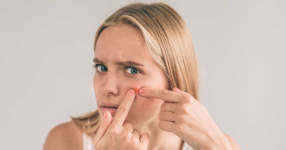 bubuljice pred menstruaciju