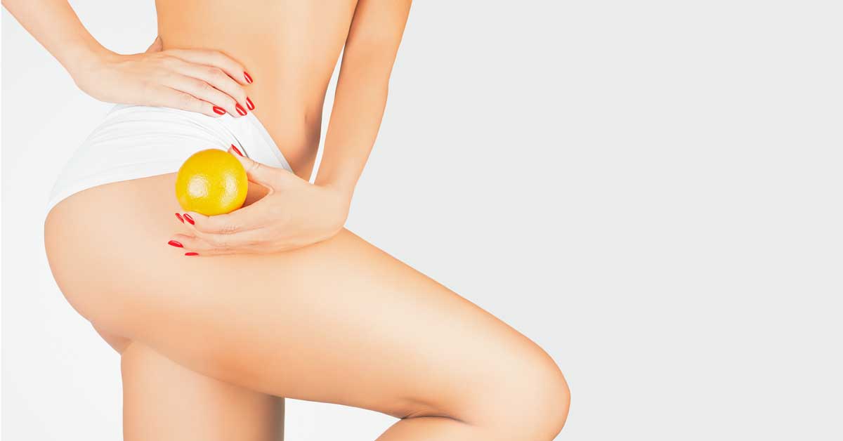  Saznajte kako se rešiti celulita prirodnim putem