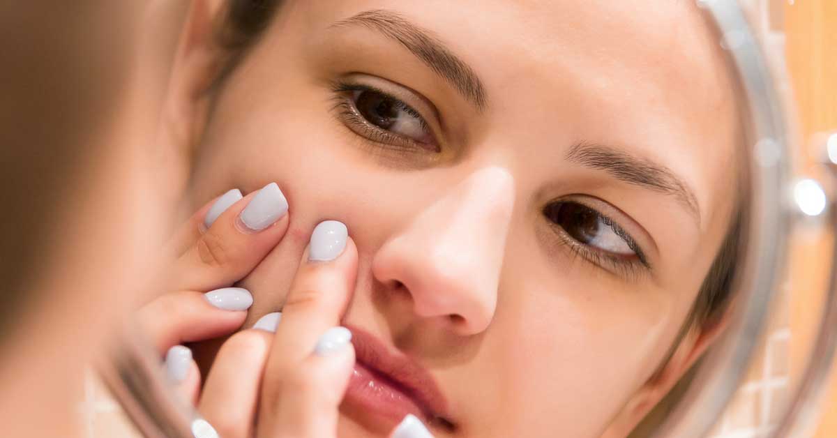  Važno je! Gnojne bubuljice nisu samo estetski problem!