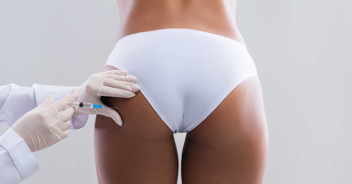  Šta je lipoliza? Pojam,cena i iskustva