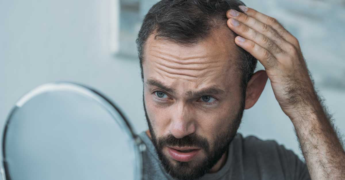  Kako izazvati ponovni rast kose na zaliscima