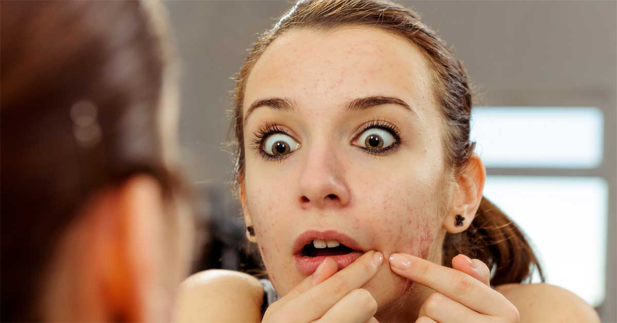 mladalačke bubuljice