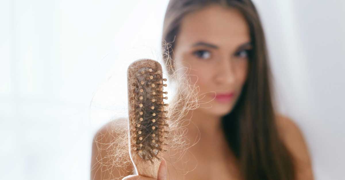 opadanje kose zbog nedostatka vitamina