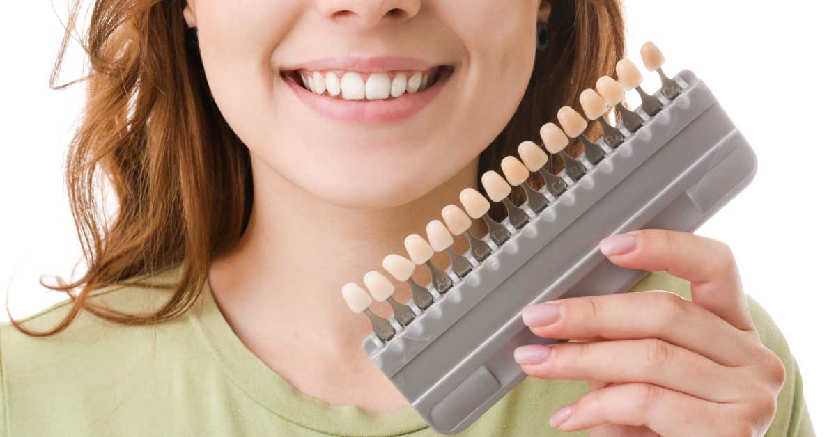  Kako izbeliti zube i imati osmeh kao Jelena Đoković