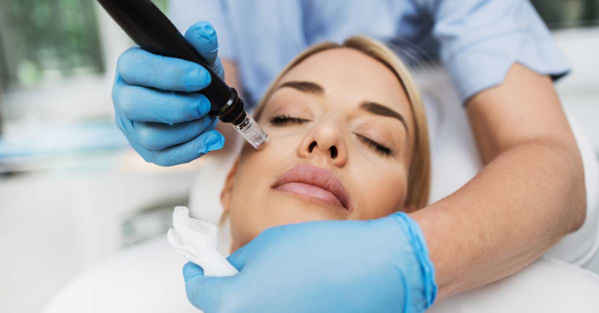  Da li mezoterapija lica moze da vas podmladi?