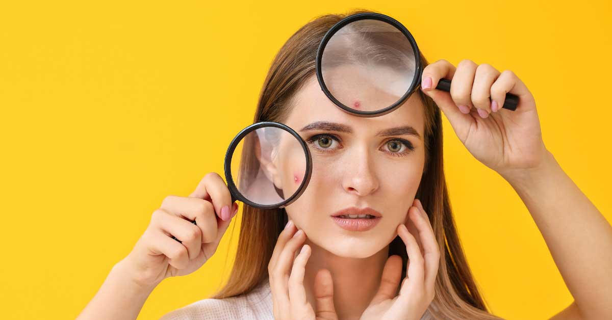  Bubuljice od znoja kažite im zbogom