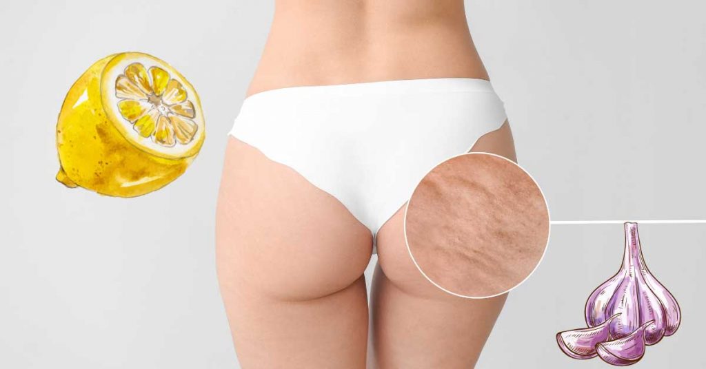 limun i beli luk za celulit