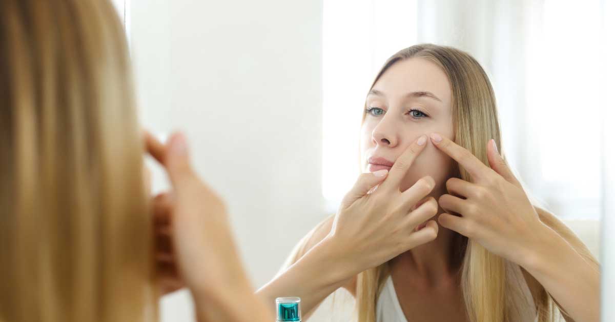  Saznajte kako jednostavno ukloniti mitisere!