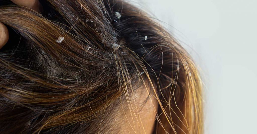 mycoseb šampon upotreba