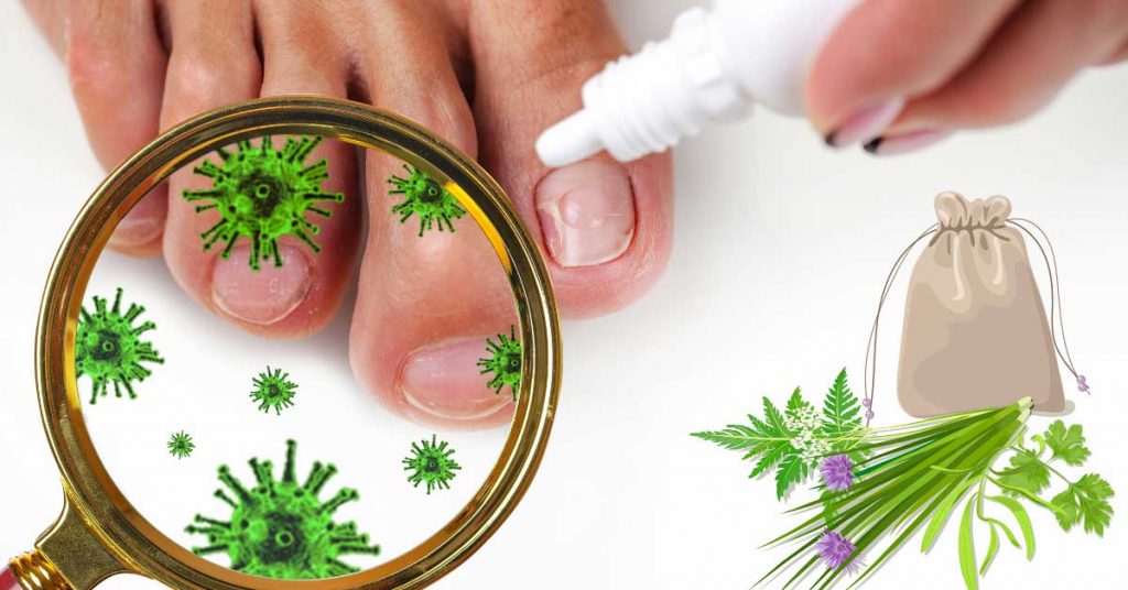prirodni lek za gljivice na noktima