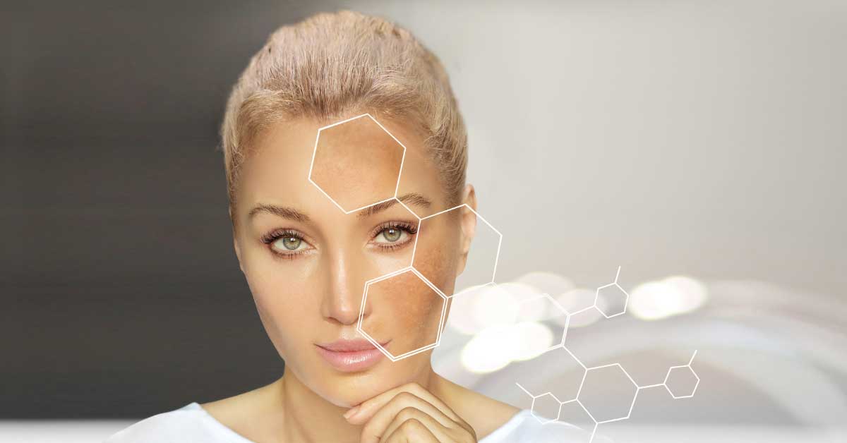  Otkrijte kako ukloniti fleke sa lica!