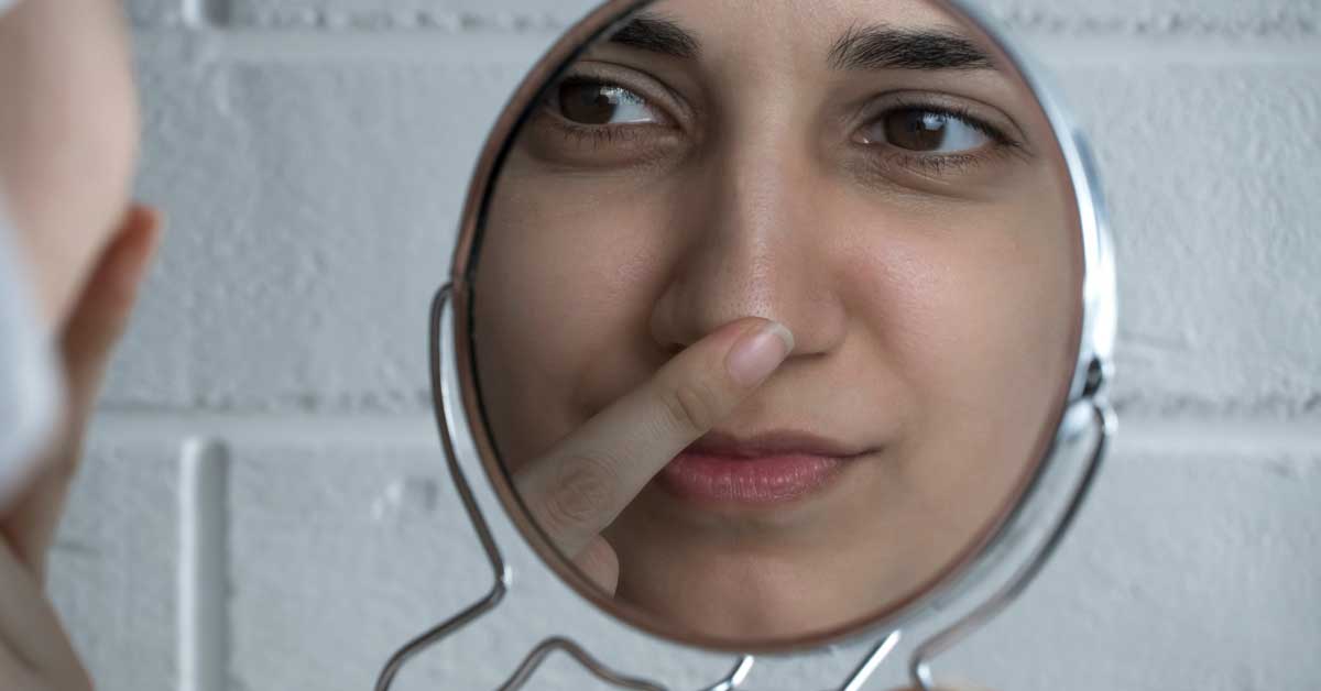  Zašto nastaju komedoni na licu i kako ih se rešiti