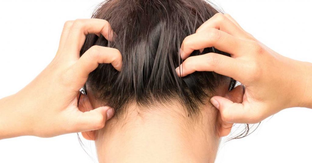 šampon za svrab glave