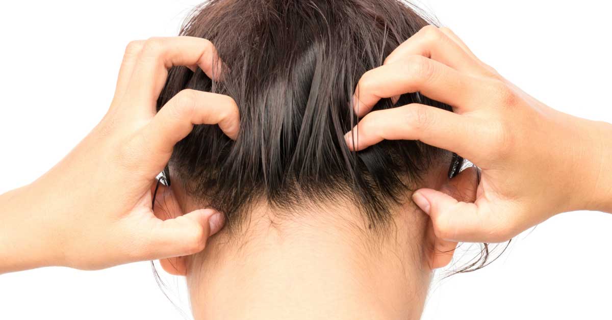  Najbolji šampon za svrab glave koji donosi olakšanje