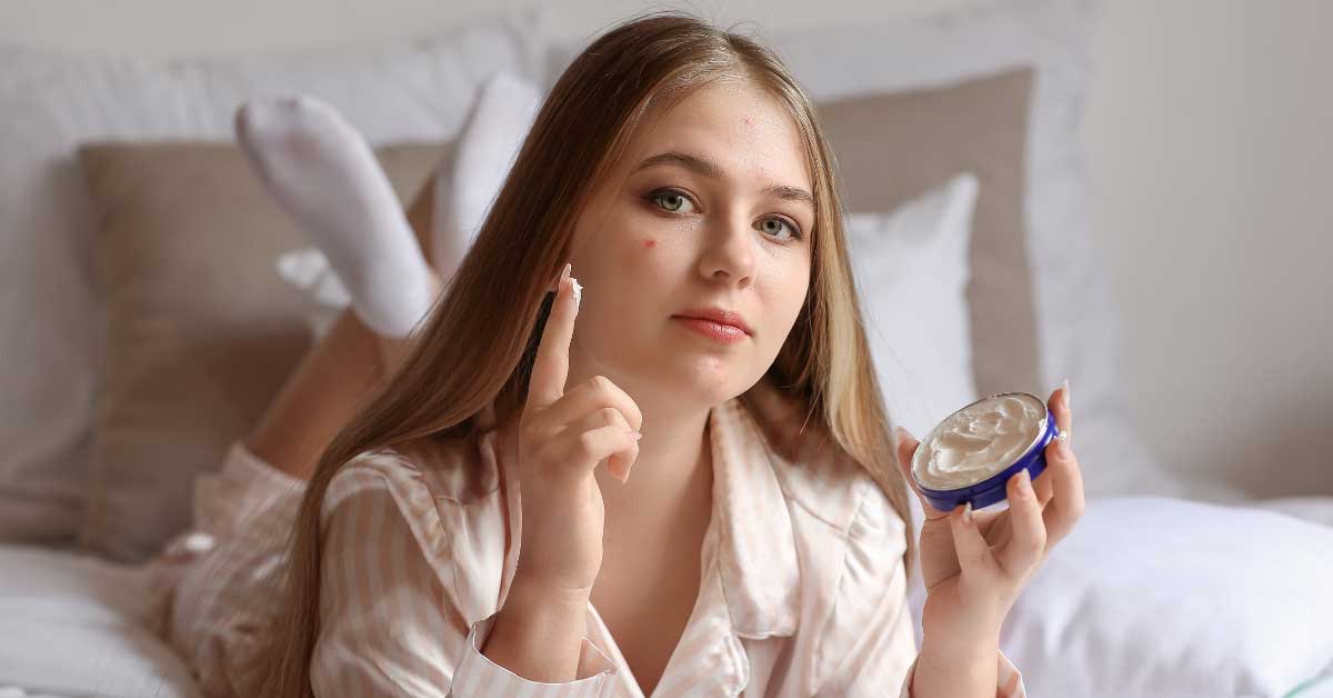  Strategija za lečenje akni na licu koja pomaže