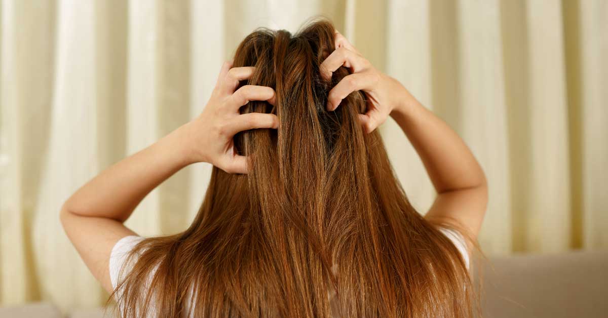  Problematično vlasište i šta sa njim!