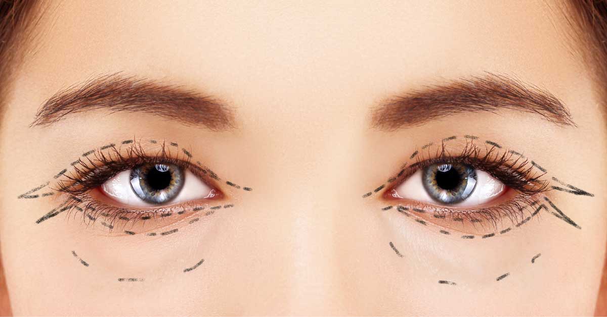  ZA i PROTIV operacije podočnjaka