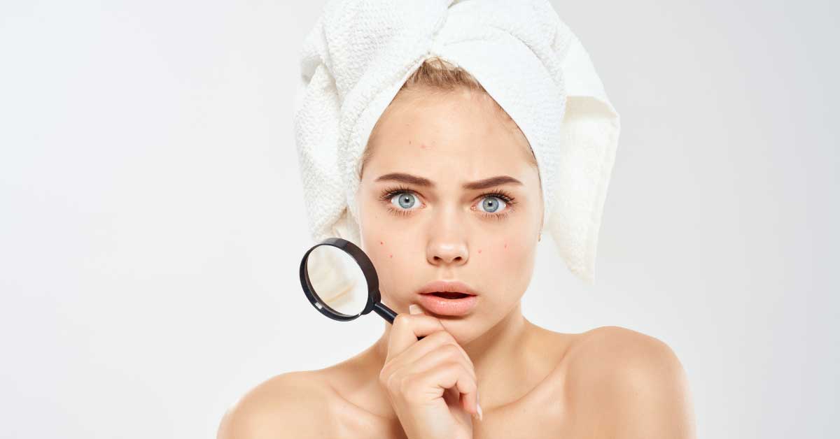  Problematična koža i vodič kroz njenu negu
