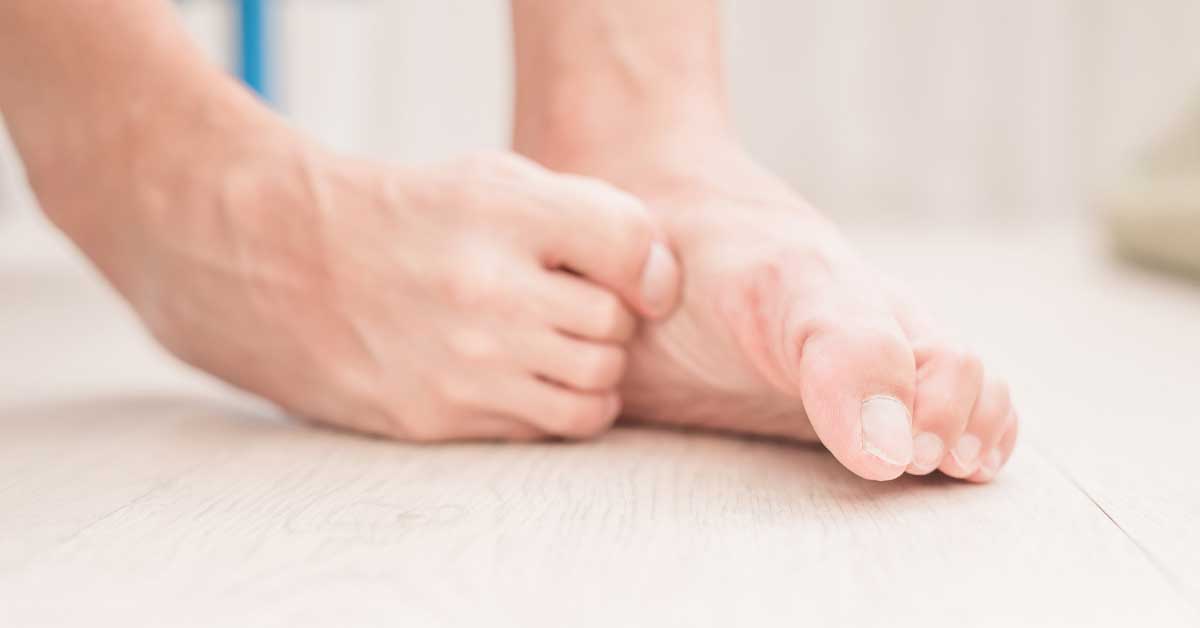  Atletsko stopalo simptomi i kako ga se rešiti