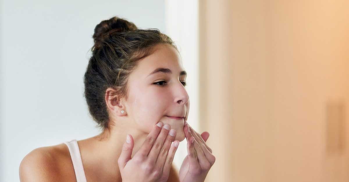  Pravilno ceđenje mitisera korak po korak