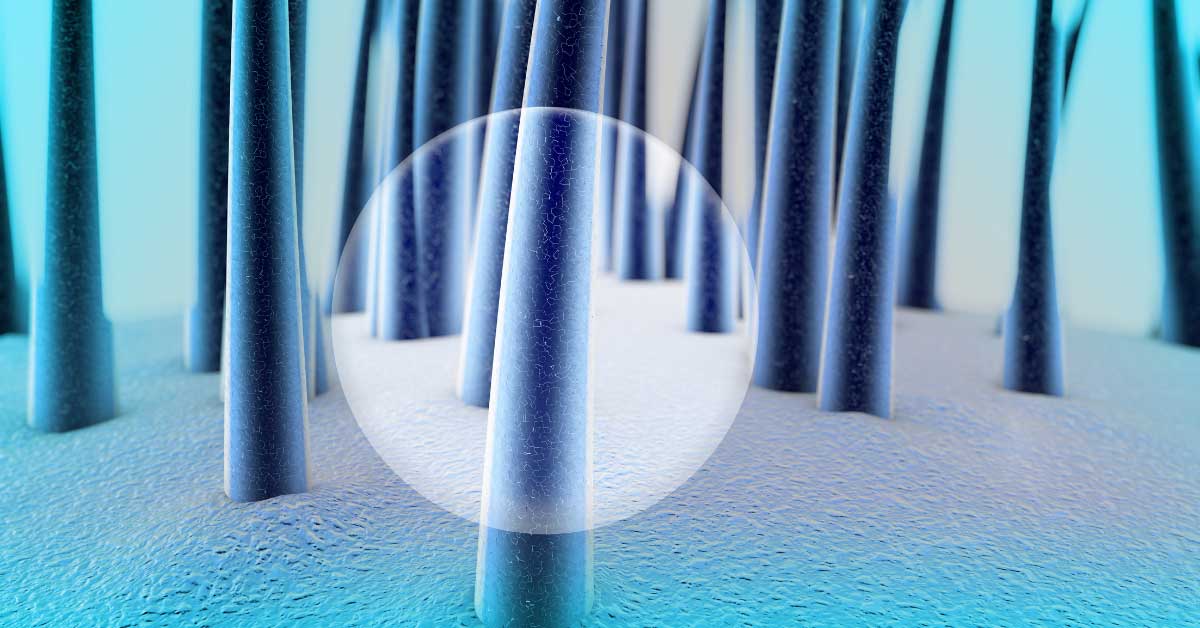  Ketokonazol šampon je pravo rešenje za perut ili ne?!