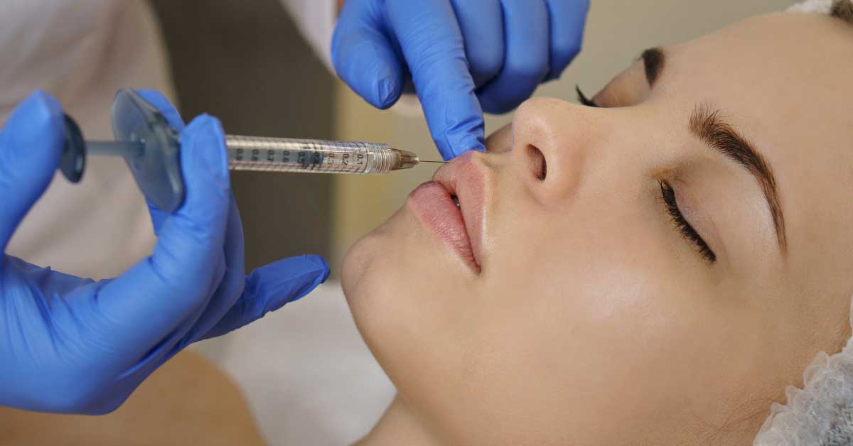  Vodič kroz punjenje usana sopstvenim masnim tkivom