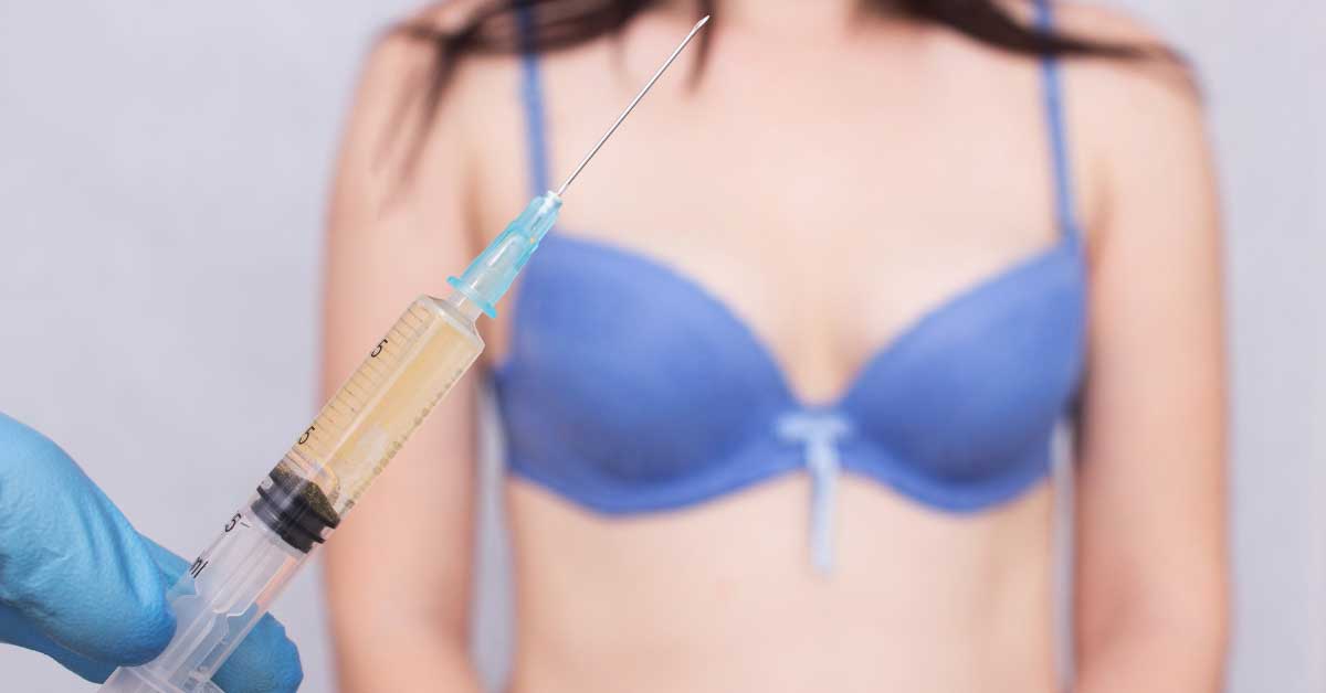  Upoznajte povećanje grudi vlastitim masnim tkivom