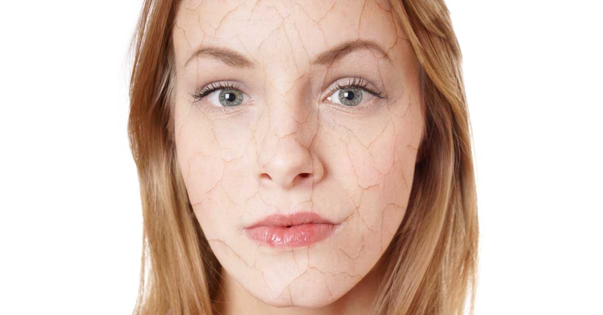  Suva koža lica biće prošlost ako je negujete ovako!
