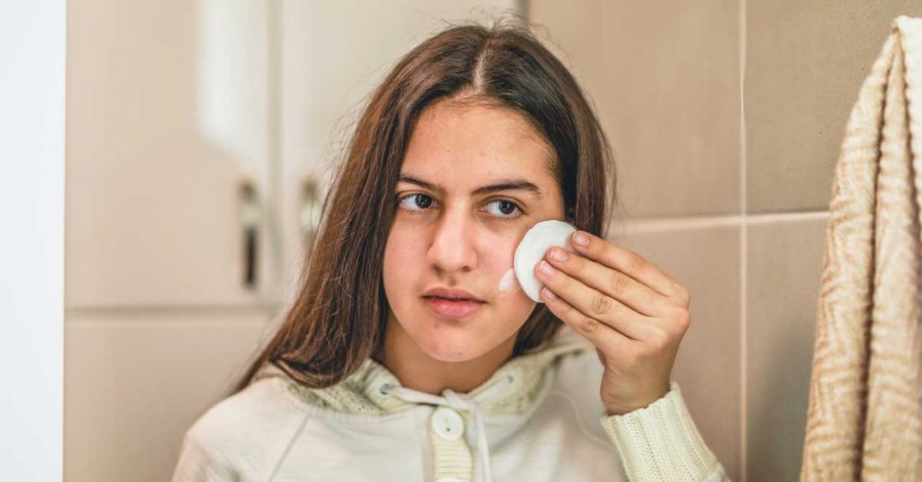 pubertetske bubuljice